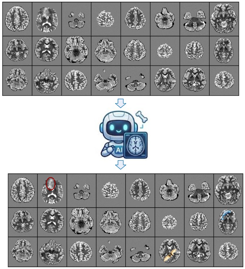 A grid of brain MRI slices passed through an AI model, producing a grid with an anomalous region highlighted