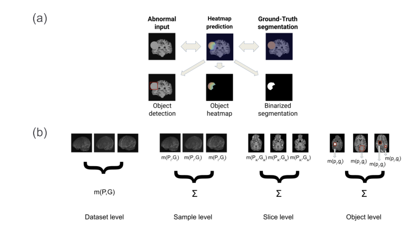 Overview of the anomaly localization problem and the four levels of evaluation: dataset, sample, slice and object level